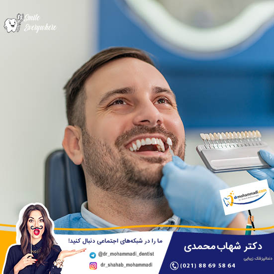 چطور با مراقبت های پس از لمینت دندان، عمر لمینت دندان را افزایش دهیم؟ - کلینیک دندانپزشکی دکتر شهاب محمدی